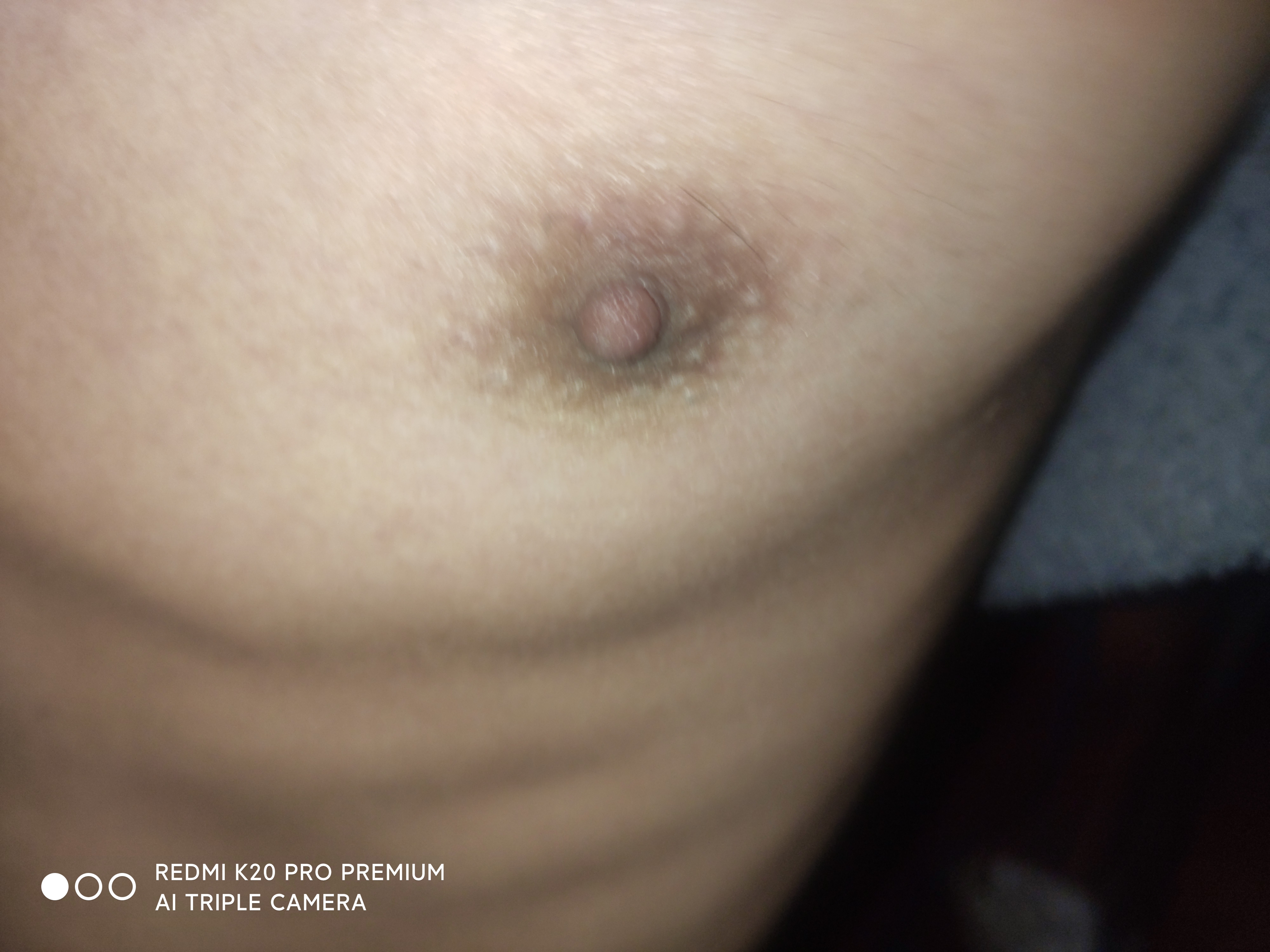 我好像乳头开发失败了- 生如夏花论坛