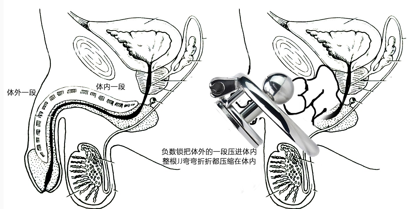 负数锁